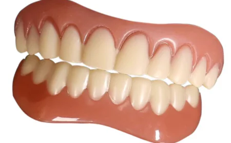 How Long Can You Expect Veneers to Last?